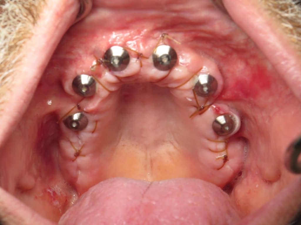 Gums look nice one day after surgery