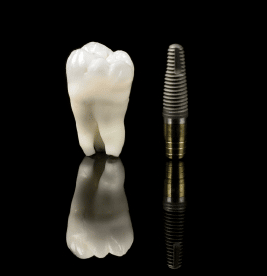 dental implants Burbank CA