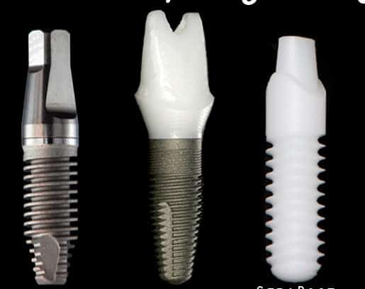 zirconia dental implant in comparison