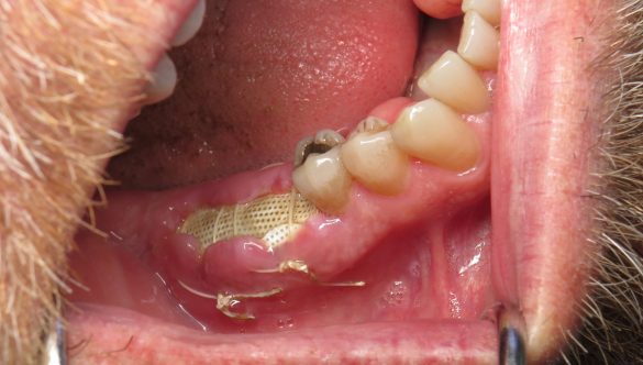 Dental Bone Grafts Archives | Ramsey Amin, DDS