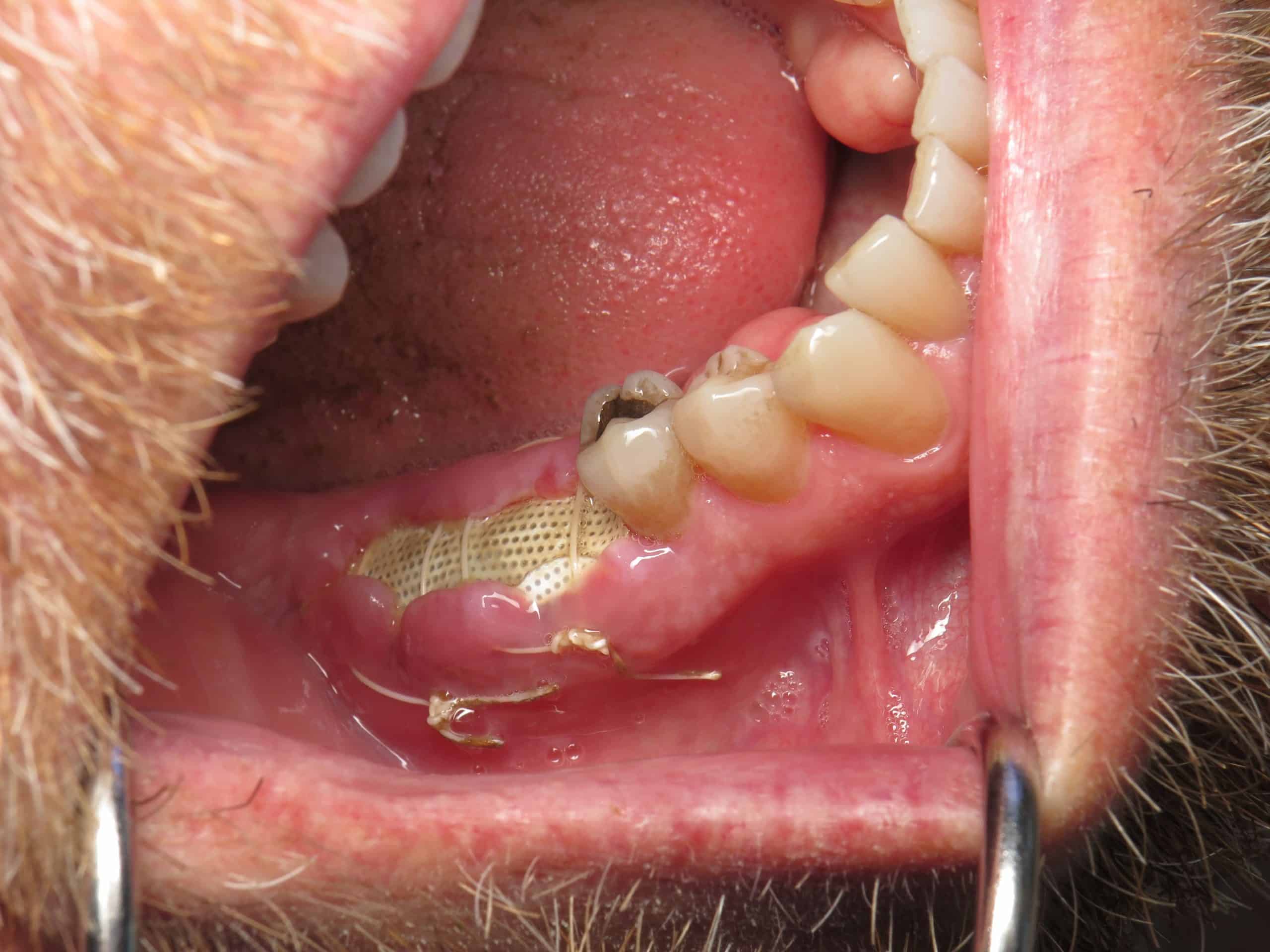 normal healing after tooth extraction