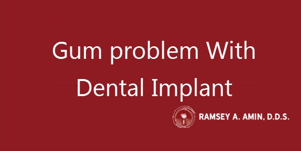 gum problem with dental implant