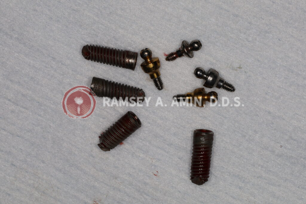 dental implant parts