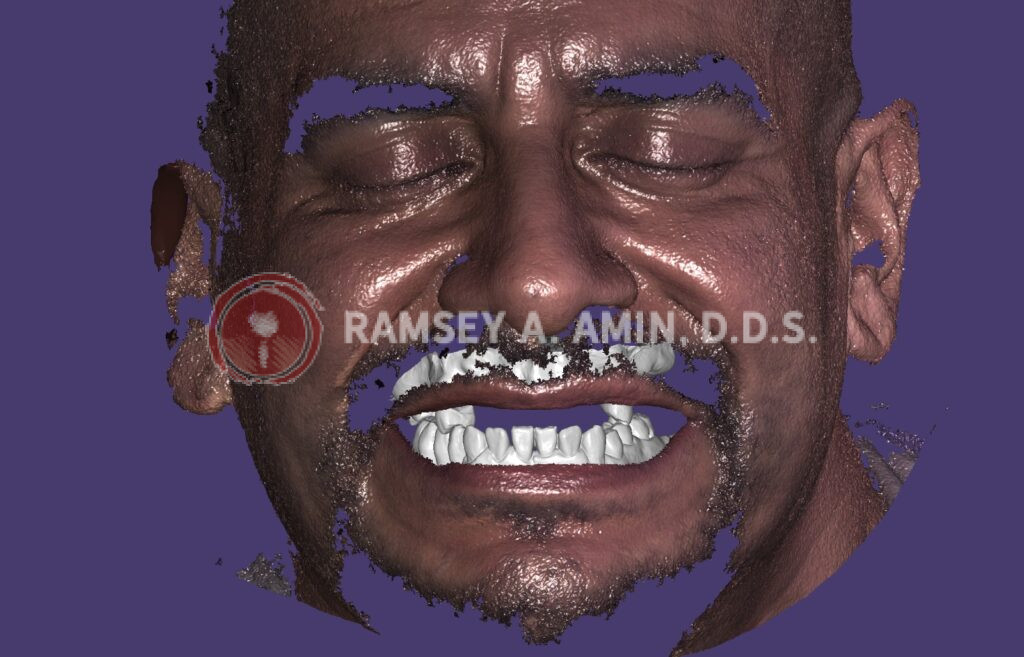 digital facial scanning technology to simulate a future smile - by Ramsey Amin, DDS