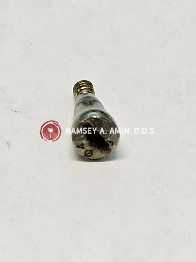 broken implant parts by Ramsey Amin DDS
