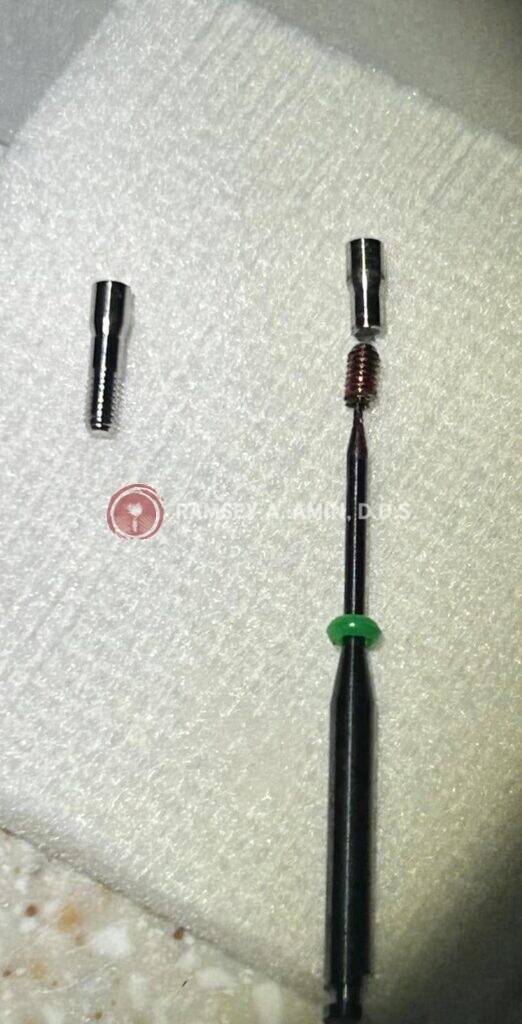 dental implant pieces by Ramsey Amin DDS of Burbank Dental Implants