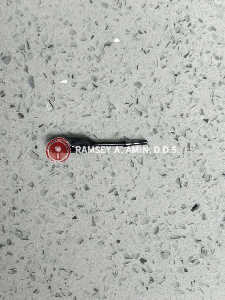 part of a dental implant shown by Ramsey Amin DDS of Burbank Dental Implants